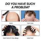 Hair Boost Spray, Ginger Multiflorum Essence Moisturizes Scalp And Prevents Hair Loss