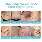 Scarfree Advanced Skin Spray, Body Skin Care Reduces Post-Natal Scars And Smooths Skin