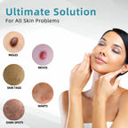 Aurenza QIAWI™ All-in-One CO₂ Laser Eraser Pen (ENN-VHH) for removing moles, warts, skin flaws, and pigmentation.