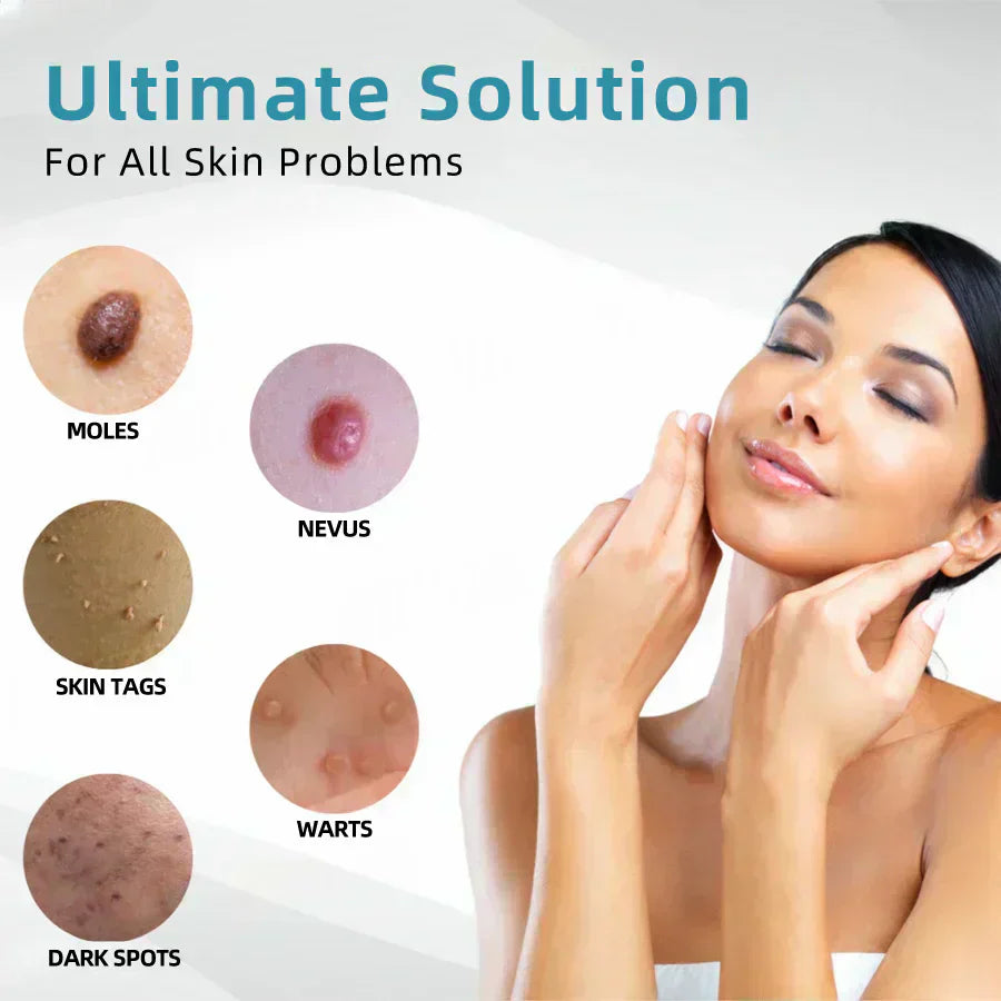 Aurenza QIAWI™ All-in-One CO₂ Laser Eraser Pen (ENN-VHH) for removing moles, warts, skin flaws, and pigmentation.