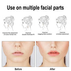 Facial Lifting Patch, Lift Face Double Chin V Face Melon Seed Face Invisible Lifting Patch