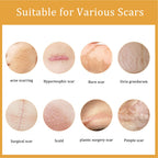 Desalting Skin Scar Cream, Skin Burn Scalding Surgical Scar Wound Repair Cream