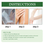 Psoriasis Cream, Relieve Itchy Skin Of Hands And Feet Skin Moss Body Skin Care Cream
