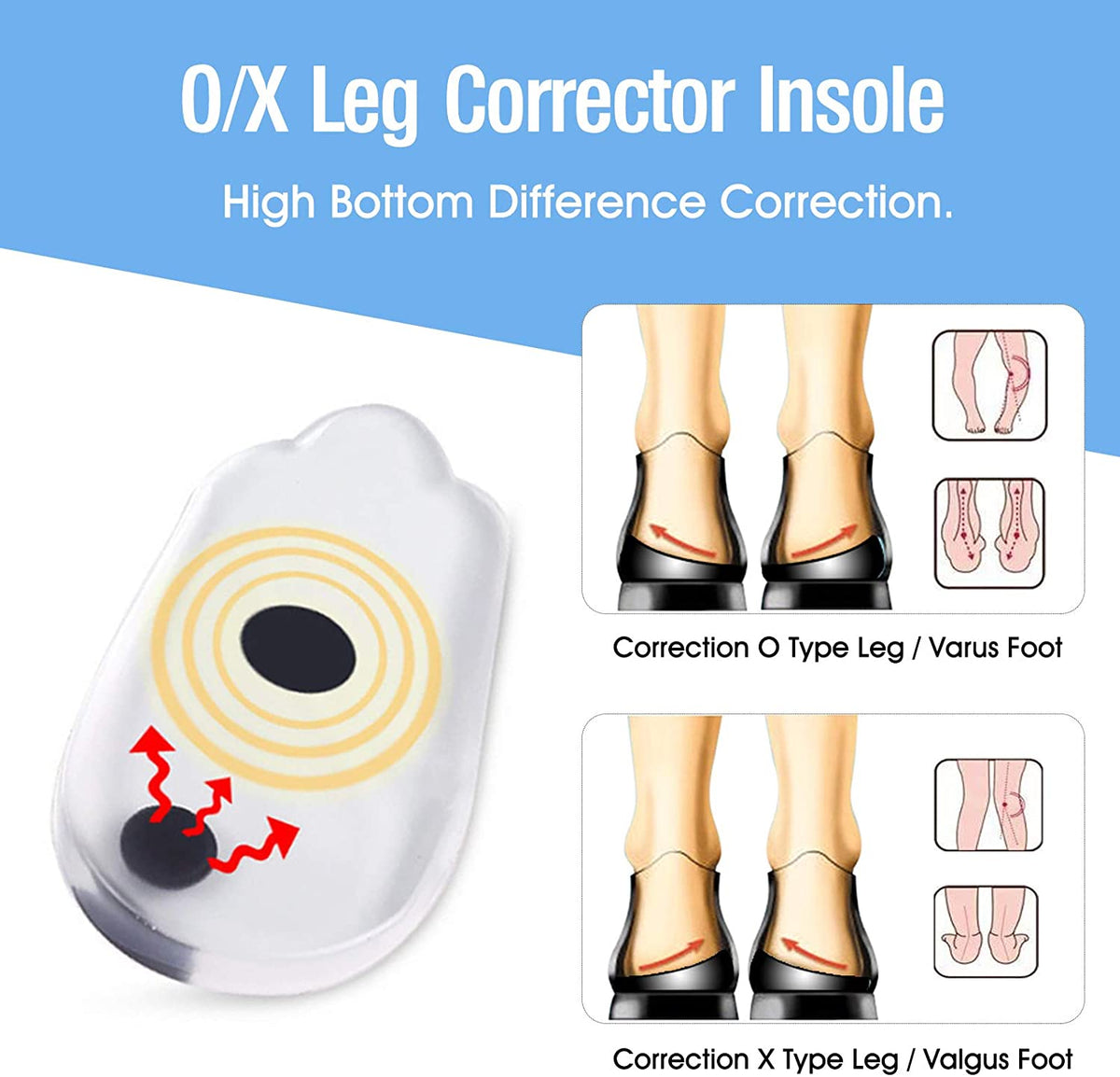 2PCS Insoles Correction Shoe Inserts Pads Effective O/X Type Leg Bowed Legs Knee Valgum Straightening for Women Men Health Care