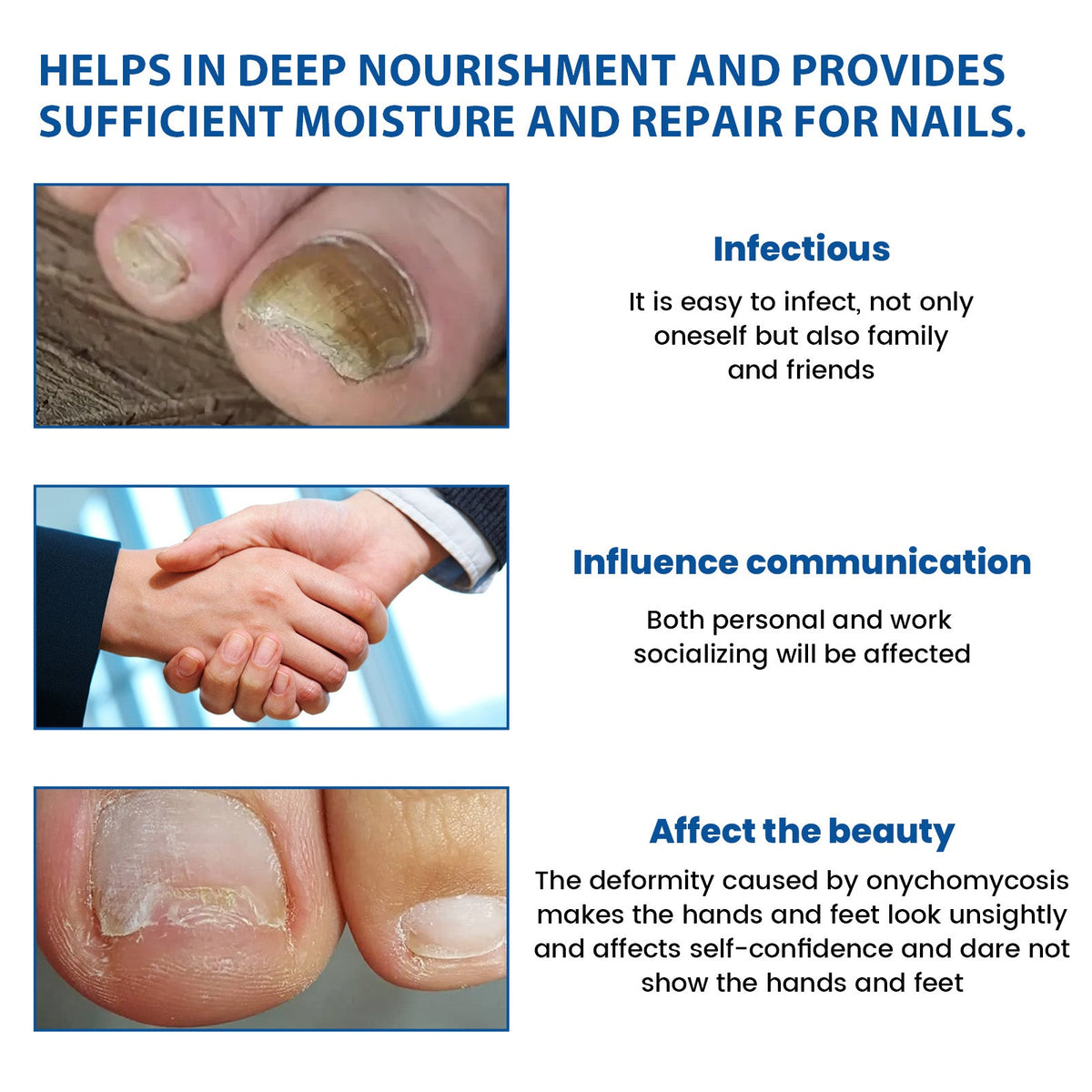 Nighttime Renewal Fungal Nail Patches, Repair And Thickening Gray Nail Insert Soft Nail Care Patch