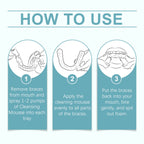 Braces Cleansing Mousse, Teeth And Mouth Fresher Corrector Gentle Cleansing Foam