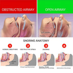 Anti-Snoring Braces Anti-Snoring, Anti-Grinding, Anti-Breathing Mouth Guard Anti-Snoring Dental Support Protective Braces