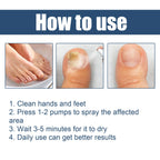 Nail Care Spray Gently Cleans Foot Nails Moisturizing And Brightening Nail Care Spray