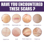 Silicone Scar Patch, Reduces Stretch Marks And Hyperplasia Of Caesarean Section Scars Silicone Patch