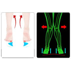 2Pc Arch Support Insole Of Flatfoot Gel Pads For Feet Orthotics Insoles Foot Health Care Massage Muscle Resist Painful Massager