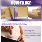 Silicone Scar Patch, Reduces Stretch Marks And Hyperplasia Of Caesarean Section Scars Silicone Patch