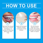Denture Cleaner Spray, Denture Cleaner Cosmetic Teeth Denture Cleaner Spray Portable