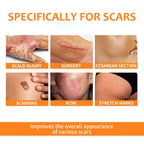 Skin Repair Pen For Reducing Pregnancy Burns Scars And Smoothing The Skin