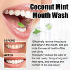Teeth Rinse, Deep Clean Mouth Fresh, Deodorizing And Whitening Teeth Stain Removing Mouthwash