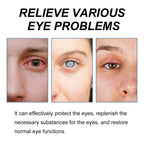 Myopic Eye Drops For Eye Fatigue, Swelling, Swelling, Blurred Vision Mild Eye Drops