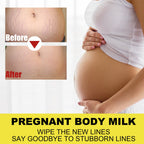 Skin Care Cream, Pregnant Women's Body Skin Gentle Repair Daily Care Moisturizing Moisturizer