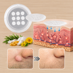 ✨2-in-1 Microneedle & Hydrocolloid Patch🍀| Removes Raised Moles, Acne, Flat Warts & Skin Tags | Helps Improve Wrinkles, Scars & Blemishes | Invisible Patches for Face & Body