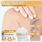 Desalting Skin Scar Cream, Skin Burn Scalding Surgical Scar Wound Repair Cream