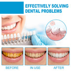 Mouth Mousse Toothpaste Teeth Clean Teeth Remove Tartar Stains Yellow Teeth Whitening Teeth Fresh Breath
