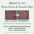 Fresh Green Rice Mochi Cleanser, Gentle Daily Cleanser for Acne-Prone Skin, 4.23oz