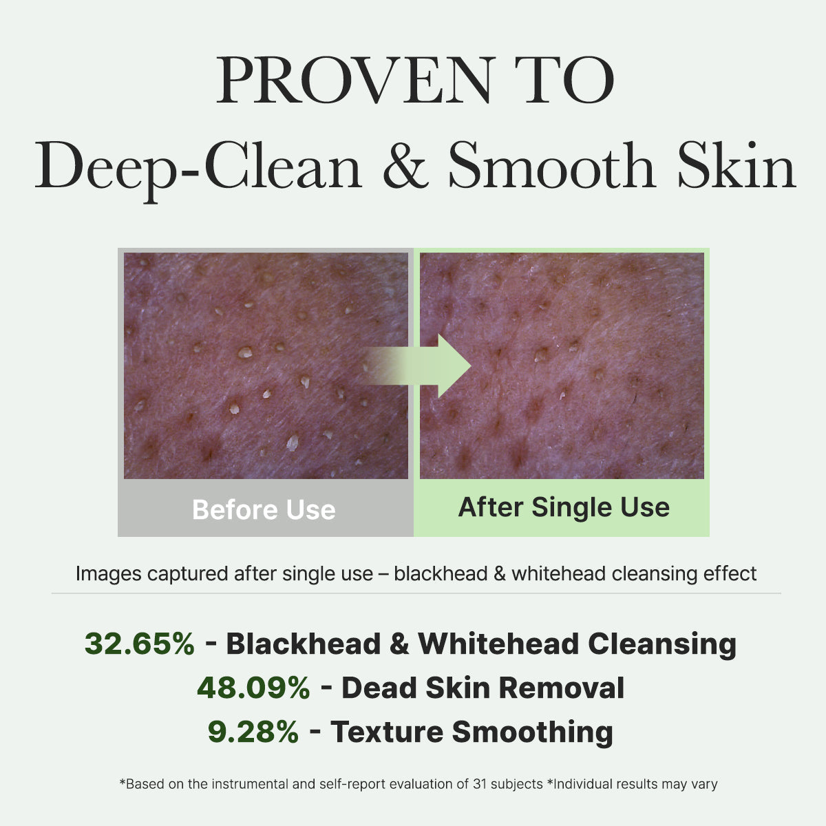 Fresh Green Rice Mochi Cleanser, Gentle Daily Cleanser for Acne-Prone Skin, 4.23oz