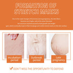 Pregnancy Massage Oil, Repair Pregnant Women Prenatal And Postpartum Stretch Mark Skin Care Massage Oil