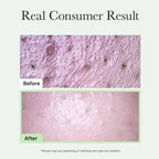 Fresh Green Rice Mochi Cleanser, Gentle Daily Cleanser for Acne-Prone Skin, 4.23oz