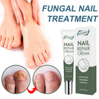 Foot Care And Thickening Nail Repair Cream. Nail Repair Cream