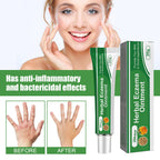 Herbal Eczema Ointment, Relieve Hand And Foot Moss Skin Redness Itchy Skin Repair Ointment