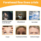 Forehead Wrinkle Patch, Lifts Lightens And Smooths Forehead Wrinkles Facial Skin Forehead Patch