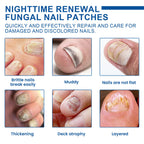 Nighttime Renewal Fungal Nail Patches, Repair And Thickening Gray Nail Insert Soft Nail Care Patch