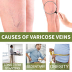 Vein Therapy Cream, Soothe Sore Swollen Leg Blood Vessels Repair Veins Body Care Cream