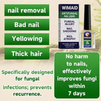 Extra Strength Nail Fungus Treatment – Triple Action Formula Repairs Thick, Yellow & Damaged Nails Fast