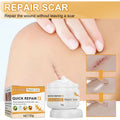 Desalting Skin Scar Cream, Skin Burn Scalding Surgical Scar Wound Repair Cream