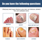 Nail Care Spray Gently Cleans Foot Nails Moisturizing And Brightening Nail Care Spray