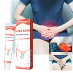 Heat Rash Treatment Cream, Alleviate The Uncomfortable Itching Clean Body Odor Care Cream For External Use Only