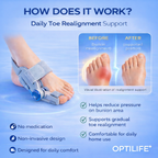 Optilife™ Bunion Fix