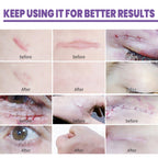 Skin Care Cream, Daily Moisturizing, Smoothing And Firming Skin Repair Postpartum Repair Topical Cream