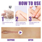 Skin Care Cream, Daily Moisturizing, Smoothing And Firming Skin Repair Postpartum Repair Topical Cream