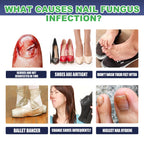 Gray Nail Repair Drops, Repair Hand And Foot Gray Nails Soft And Bright Nail Thickening Nail Care Solution