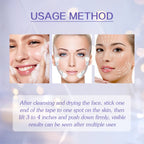 V Face Lift Face Lift To Tighten Chin And Soften Fine Lines Shaped V Melon Seed Face