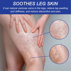 Vein Comfort Spray, Relief Leg Muscle Soreness And Swelling Earthworm Leg Vein Treatment Spray