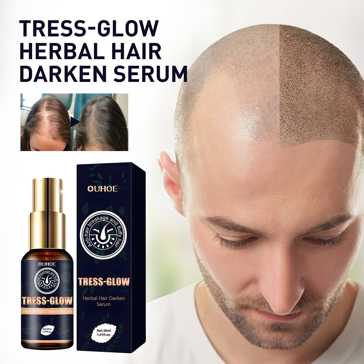 Herbal Hair Essence, Moisturizes Scalp Strong Hair Roots Thick Beard Care Essence