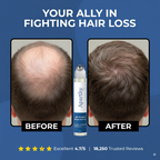 Aparthy Hair Growth Roll on Serum