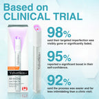 Aurenza QIAWI™ All-in-One CO₂ Laser Eraser Pen for mole, wart, skin flaw, and pigmentation removal, shown in use.