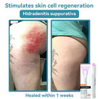 ENN-VHH QIAWI™ All-in-One CO₂ Laser Eraser Pen for removing moles, warts, skin flaws, and pigmentation, held in hand.
