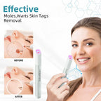 QIAWI™ All-in-One CO₂ Laser Eraser Pen by Aurenza Shop, ENN-VHH model, showing the compact laser pen device for skin flaw removal.