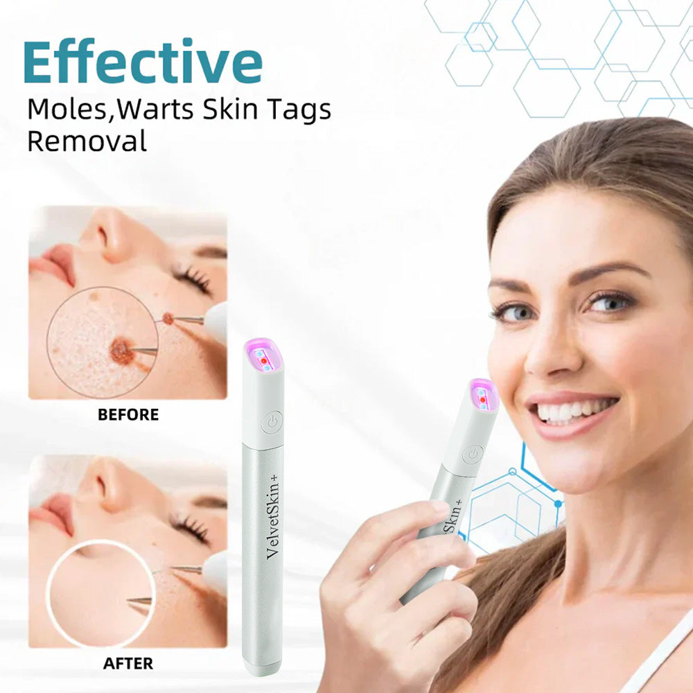 QIAWI™ All-in-One CO₂ Laser Eraser Pen by Aurenza Shop, ENN-VHH model, showing the compact laser pen device for skin flaw removal.