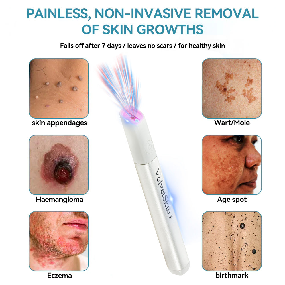 Aurenza QIAWI™ CO₂ laser eraser pen for removing moles, warts, skin flaws, and pigmentation, with a sleek handheld design.