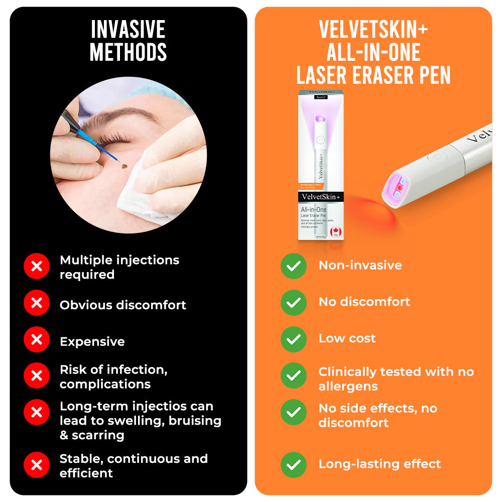 Aurenza QIAWI™ All-in-One CO₂ Laser Eraser Pen for removing moles, warts, skin flaws, and pigmentation, with a sleek design.